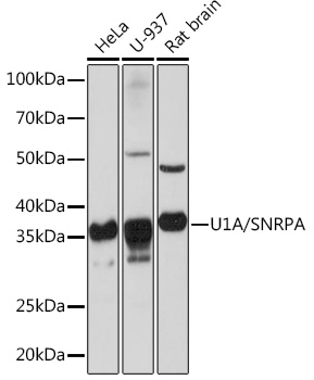 Western blot analysis of various lysates using U1A/SNRPA Rabbit mAb (A3686) at 1:1000 dilution.|Secondary antibody: HRP-conjugated Goat anti-Rabbit IgG (H+L) (AS014) at 1:10000 dilution.|Lysates/proteins: 25μg per lane.|Blocking buffer: 3% nonfat dry milk in TBST.|Detection: ECL Basic Kit (RM00020).|Exposure time: 1s.