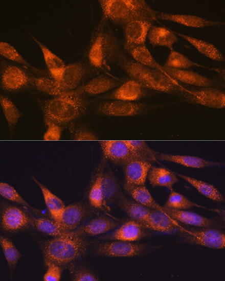 Immunofluorescence analysis of NIH/3T3 cells using RheB Rabbit mAb at dilution of 1:100 (40x lens). Secondary antibody: Cy3-conjugated Goat anti-Rabbit IgG (H+L) at 1:500 dilution. Blue: DAPI for nuclear staining.