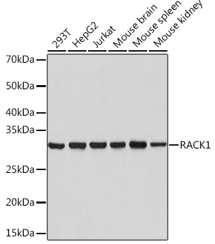 Western blot analysis of various lysates using RACK1 Rabbit mAb at 1:1000 dilution.|Secondary antibody: HRP-conjugated Goat anti-Rabbit IgG (H+L) at 1:10000 dilution.|Lysates/proteins: 25μg per lane.|Blocking buffer: 3% nonfat dry milk in TBST.|Detection: ECL Basic Kit.|Exposure time: 1s.