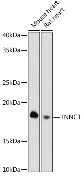 Western blot analysis of various lysates using TNNC1 Rabbit mAb (A3816) at 1:1000 dilution.|Secondary antibody: HRP-conjugated Goat anti-Rabbit IgG (H+L) (AS014) at 1:10000 dilution.|Lysates/proteins: 25μg per lane.|Blocking buffer: 3% nonfat dry milk in TBST.|Detection: ECL Basic Kit (RM00020).|Exposure time: 180s.
