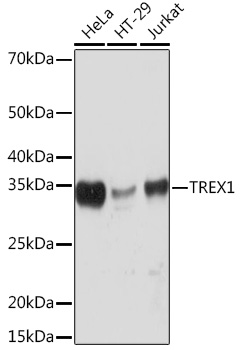 Western blot analysis of various lysates using TREX1 Rabbit mAb (A3819) at 1:1000 dilution.|Secondary antibody: HRP-conjugated Goat anti-Rabbit IgG (H+L) (AS014) at 1:10000 dilution.|Lysates/proteins: 25μg per lane.|Blocking buffer: 3% nonfat dry milk in TBST.|Detection: ECL Basic Kit (RM00020).|Exposure time: 10s.