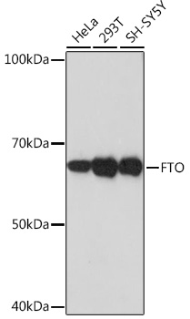 Western blot analysis of various lysates using FTO Rabbit mAb at 1:1000 dilution.|Secondary antibody: HRP-conjugated Goat anti-Rabbit IgG (H+L) at 1:10000 dilution.|Lysates/proteins: 25μg per lane.|Blocking buffer: 3% nonfat dry milk in TBST.|Detection: ECL Basic Kit.|Exposure time: 3min.