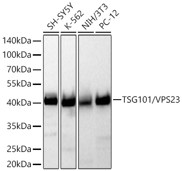 Western blot analysis of various lysates using TSG101/VPS23 Rabbit mAb (A5789) at 1:1000 dilution incubated at room temperature for 1.5 hours.|Secondary antibody: HRP-conjugated Goat anti-Rabbit IgG (H+L) (AS014) at 1:10000 dilution.|Lysates/proteins: 25 μg per lane.|Blocking buffer: 3% nonfat dry milk in TBST.|Detection: ECL Basic Kit (RM00020).|Exposure time: 45 s.
