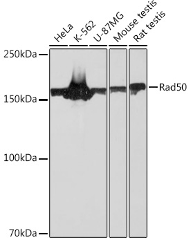 Western blot analysis of various lysates using Rad50 Rabbit mAb at 1:1000 dilution.|Secondary antibody: HRP-conjugated Goat anti-Rabbit IgG (H+L) at 1:10000 dilution.|Lysates/proteins: 25μg per lane.|Blocking buffer: 3% nonfat dry milk in TBST.|Detection: ECL Basic Kit.|Exposure time: 30s.