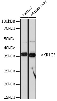 Western blot analysis of various lysates using AKR1C3 Rabbit mAb at 1:1000 dilution.|Secondary antibody: HRP-conjugated Goat anti-Rabbit IgG (H+L) at 1:10000 dilution.|Lysates/proteins: 25μg per lane.|Blocking buffer: 3% nonfat dry milk in TBST.|Detection: ECL Basic Kit.|Exposure time: 10s.