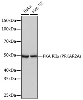 Western blot analysis of various lysates using PKA RIIα (PRKAR2A) Rabbit mAb at 1:1000 dilution.|Secondary antibody: HRP-conjugated Goat anti-Rabbit IgG (H+L) at 1:10000 dilution.|Lysates/proteins: 25μg per lane.|Blocking buffer: 3% nonfat dry milk in TBST.|Detection: ECL Basic Kit.|Exposure time: 3s.