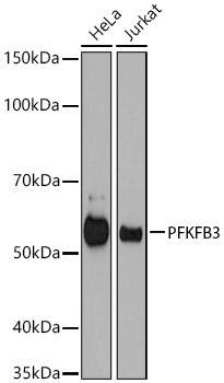 Western blot analysis of various lysates using PFKFB3 Rabbit mAb at 1:500 dilution.|Secondary antibody: HRP-conjugated Goat anti-Rabbit IgG (H+L) at 1:10000 dilution.|Lysates/proteins: 25μg per lane.|Blocking buffer: 3% nonfat dry milk in TBST.|Detection: ECL Basic Kit.|Exposure time: 60s.