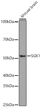 Western blot analysis of various lysates using SGK1 Rabbit mAb at 1:1000 dilution.|Secondary antibody: HRP-conjugated Goat anti-Rabbit IgG (H+L) at 1:10000 dilution.|Lysates/proteins: 25μg per lane.|Blocking buffer: 3% nonfat dry milk in TBST.|Detection: ECL Basic Kit.|Exposure time: 3min.