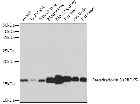 Western blot analysis of various lysates using Peroxiredoxin 5 (PRDX5) Rabbit mAb at 1:1000 dilution incubated overnight at 4°C.|Secondary antibody: HRP-conjugated Goat anti-Rabbit IgG (H+L) at 1:10148 dilution.|Lysates/proteins: 25 μg per lane.|Blocking buffer: 3% nonfat dry milk in TBST.|Detection: ECL Basic Kit.|Exposure time: 30 s.
