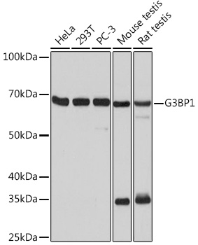 Western blot analysis of various lysates using G3BP1 Rabbit mAb at 1:1000 dilution.|Secondary antibody: HRP-conjugated Goat anti-Rabbit IgG (H+L) at 1:10000 dilution.|Lysates/proteins: 25μg per lane.|Blocking buffer: 3% nonfat dry milk in TBST.|Detection: ECL Basic Kit.|Exposure time: 10s.