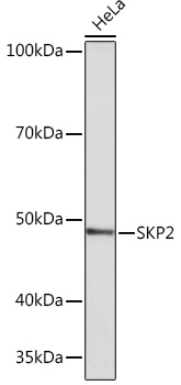 Western blot analysis of lysates from HeLa cells, using SKP2 Rabbit mAb at 1:1000 dilution.|Secondary antibody: HRP-conjugated Goat anti-Rabbit IgG (H+L) at 1:10000 dilution.|Lysates/proteins: 25μg per lane.|Blocking buffer: 3% nonfat dry milk in TBST.|Detection: ECL Basic Kit.|Exposure time: 3min.