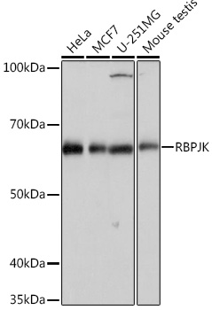 Western blot analysis of various lysates using RBPJK Rabbit mAb at 1:1000 dilution.|Secondary antibody: HRP-conjugated Goat anti-Rabbit IgG (H+L) at 1:10000 dilution.|Lysates/proteins: 25μg per lane.|Blocking buffer: 3% nonfat dry milk in TBST.|Detection: ECL Basic Kit.|Exposure time: 10s.