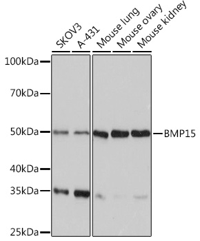 Western blot analysis of various lysates using BMP15 Rabbit mAb at 1:1000 dilution.|Secondary antibody: HRP-conjugated Goat anti-Rabbit IgG (H+L) at 1:10000 dilution.|Lysates/proteins: 25μg per lane.|Blocking buffer: 3% nonfat dry milk in TBST.|Detection: ECL Basic Kit.|Exposure time: 180s.