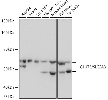 Western blot analysis of various lysates using GLUT3/SLC2A3 Rabbit mAb at 1:1000 dilution.|Secondary antibody: HRP-conjugated Goat anti-Rabbit IgG (H+L) at 1:10000 dilution.|Lysates/proteins: 25μg per lane.|Blocking buffer: 3% nonfat dry milk in TBST.|Detection: ECL Basic Kit.|Exposure time: 1s.