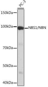 Western blot analysis of lysates from PC-3 cells, using NBS1/NBN Rabbit mAb at 1:1000 dilution.|Secondary antibody: HRP-conjugated Goat anti-Rabbit IgG (H+L) at 1:10000 dilution.|Lysates/proteins: 25μg per lane.|Blocking buffer: 3% nonfat dry milk in TBST.|Detection: ECL Basic Kit.|Exposure time: 90s.