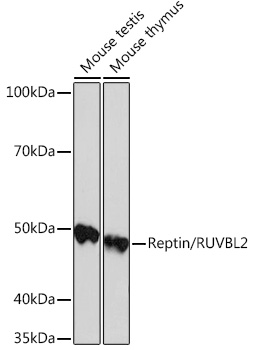 Western blot analysis of various lysates using Reptin/RUVBL2 Rabbit mAb at 1:1000 dilution.|Secondary antibody: HRP-conjugated Goat anti-Rabbit IgG (H+L) at 1:10000 dilution.|Lysates/proteins: 25μg per lane.|Blocking buffer: 3% nonfat dry milk in TBST.|Detection: ECL Basic Kit.|Exposure time: 90s.