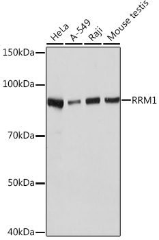 Western blot analysis of various lysates using RRM1 Rabbit mAb at 1:1000 dilution.|Secondary antibody: HRP-conjugated Goat anti-Rabbit IgG (H+L) at 1:10000 dilution.|Lysates/proteins: 25μg per lane.|Blocking buffer: 3% nonfat dry milk in TBST.|Detection: ECL Basic Kit.|Exposure time: 5s.
