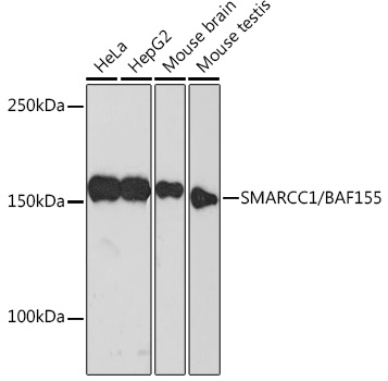 Western blot analysis of various lysates using SMARCC1/BAF155 Rabbit mAb (A4275) at 1:500 dilution.|Secondary antibody: HRP-conjugated Goat anti-Rabbit IgG (H+L) (AS014) at 1:10000 dilution.|Lysates/proteins: 25μg per lane.|Blocking buffer: 3% nonfat dry milk in TBST.|Detection: ECL Basic Kit (RM00020).|Exposure time: 3min.