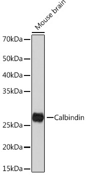 Western blot analysis of various lysates using Calbindin Rabbit mAb at 1:1000 dilution incubated overnight at 4℃.|Secondary antibody: HRP-conjugated Goat anti-Rabbit IgG (H+L) at 1:10000 dilution.|Lysates/proteins: 25 μg per lane.|Blocking buffer: 3% nonfat dry milk in TBST.|Detection: ECL Basic Kit.|Exposure time: 5 s.