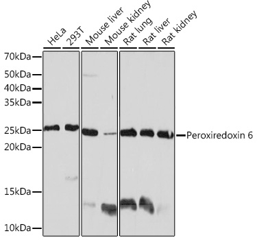 Western blot analysis of various lysates using Peroxiredoxin 6 Rabbit mAb at 1:1000 dilution.|Secondary antibody: HRP-conjugated Goat anti-Rabbit IgG (H+L) at 1:10000 dilution.|Lysates/proteins: 25μg per lane.|Blocking buffer: 3% nonfat dry milk in TBST.|Detection: ECL Basic Kit.|Exposure time: 10s.