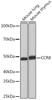 Western blot analysis of various lysates using CCR8 Rabbit mAb at 1:1000 dilution.|Secondary antibody: HRP-conjugated Goat anti-Rabbit IgG (H+L) at 1:10000 dilution.|Lysates/proteins: 25μg per lane.|Blocking buffer: 3% nonfat dry milk in TBST.|Detection: ECL Basic Kit.|Exposure time: 60s.