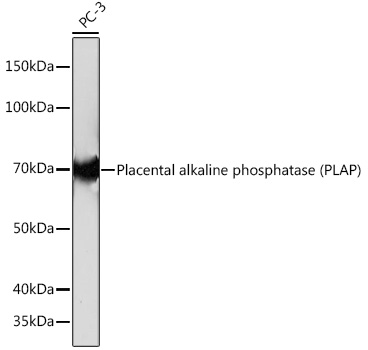 Western blot analysis of lysates from PC-3 cells, using Placental alkaline phosphatase (PLAP) Rabbit mAb at 1:1000 dilution.|Secondary antibody: HRP-conjugated Goat anti-Rabbit IgG (H+L) at 1:10000 dilution.|Lysates/proteins: 25μg per lane.|Blocking buffer: 3% nonfat dry milk in TBST.|Detection: ECL Basic Kit.|Exposure time: 10s.