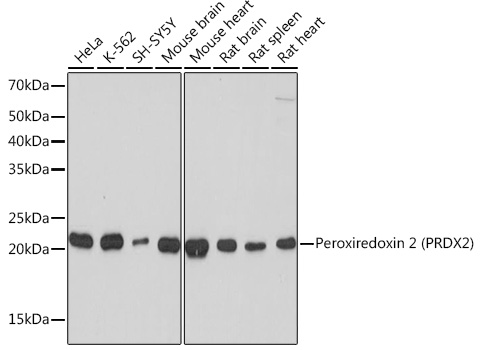 Western blot analysis of various lysates using Peroxiredoxin 2 (PRDX2) (PRDX2) Rabbit mAb at 1:1000 dilution.|Secondary antibody: HRP-conjugated Goat anti-Rabbit IgG (H+L) at 1:10000 dilution.|Lysates/proteins: 25μg per lane.|Blocking buffer: 3% nonfat dry milk in TBST.|Detection: ECL Basic Kit.|Exposure time: 1s.