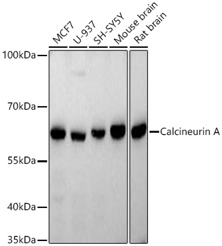 Western blot analysis of various lysates using Calcineurin A Rabbit mAb at 1:4000 dilution incubated at room temperature for 1.5 hours.|Secondary antibody: HRP-conjugated Goat anti-Rabbit IgG (H+L) at 1:10000 dilution.|Lysates/proteins: 25 μg per lane.|Blocking buffer: 3% nonfat dry milk in TBST.|Detection: ECL Basic Kit.|Exposure time: 45 s.