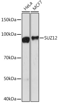 Western blot analysis of various lysates using SUZ12 Rabbit mAb at 1:1000 dilution.|Secondary antibody: HRP-conjugated Goat anti-Rabbit IgG (H+L) at 1:10000 dilution.|Lysates/proteins: 25μg per lane.|Blocking buffer: 3% nonfat dry milk in TBST.|Detection: ECL Basic Kit.|Exposure time: 90s.