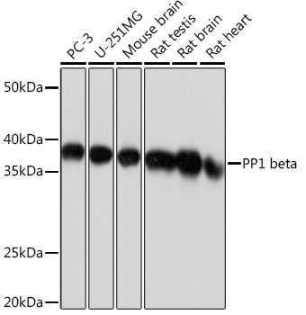 Western blot analysis of various lysates using PP1 beta Rabbit mAb at 1:1000 dilution.|Secondary antibody: HRP-conjugated Goat anti-Rabbit IgG (H+L) at 1:10000 dilution.|Lysates/proteins: 25μg per lane.|Blocking buffer: 3% nonfat dry milk in TBST.|Detection: ECL Basic Kit.|Exposure time: 1s.