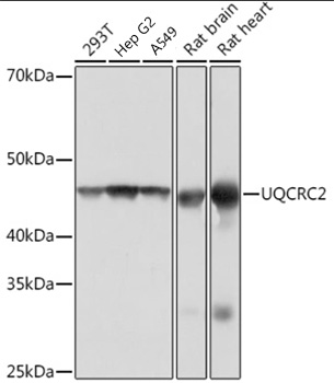 Western blot analysis of various lysates using UQCRC2  Rabbit mAb (A4366) at 1:1000 dilution.|Secondary antibody: HRP-conjugated Goat anti-Rabbit IgG (H+L) (AS014) at 1:10000 dilution.|Lysates/proteins: 25μg per lane.|Blocking buffer: 3% nonfat dry milk in TBST.|Detection: ECL Basic Kit (RM00020).|Exposure time: 1s.