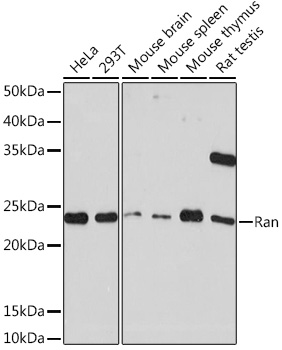Western blot analysis of various lysates using Ran Rabbit mAb at 1:1000 dilution.|Secondary antibody: HRP-conjugated Goat anti-Rabbit IgG (H+L) at 1:10000 dilution.|Lysates/proteins: 25μg per lane.|Blocking buffer: 3% nonfat dry milk in TBST.|Detection: ECL Basic Kit.|Exposure time: 10s.