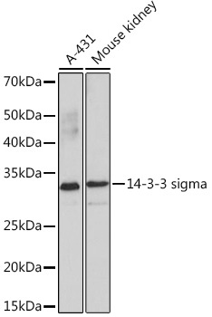 Western blot analysis of various lysates using 14-3-3 sigma Rabbit mAb (A4377) at 1:1000 dilution.|Secondary antibody: HRP-conjugated Goat anti-Rabbit IgG (H+L) (AS014) at 1:10000 dilution.|Lysates/proteins: 25μg per lane.|Blocking buffer: 3% nonfat dry milk in TBST.|Detection: ECL Basic Kit (RM00020).|Exposure time: 3min.