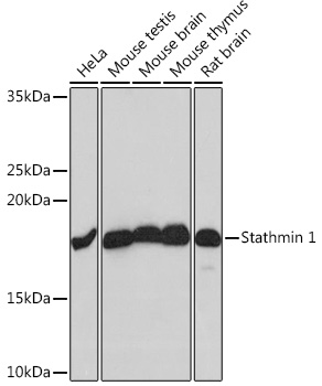Western blot analysis of various lysates using Stathmin 1 Rabbit mAb at 1:1000 dilution.|Secondary antibody: HRP-conjugated Goat anti-Rabbit IgG (H+L) at 1:10000 dilution.|Lysates/proteins: 25μg per lane.|Blocking buffer: 3% nonfat dry milk in TBST.|Detection: ECL Basic Kit.|Exposure time: 10s.