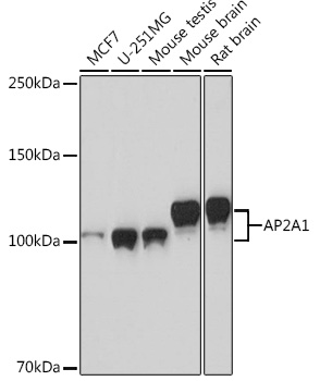 Western blot analysis of various lysates using AP2A1 Rabbit mAb at 1:1000 dilution.|Secondary antibody: HRP-conjugated Goat anti-Rabbit IgG (H+L) at 1:10000 dilution.|Lysates/proteins: 25μg per lane.|Blocking buffer: 3% nonfat dry milk in TBST.|Detection: ECL Basic Kit.|Exposure time: 90s.