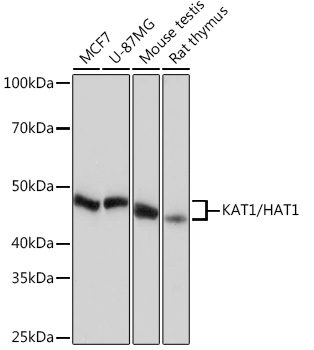 Western blot analysis of various lysates using [KO Validated] KAT1/HAT1 Rabbit mAb (A4423) at 1:1000 dilution.|Secondary antibody: HRP-conjugated Goat anti-Rabbit IgG (H+L) (AS014) at 1:10000 dilution.|Lysates/proteins: 25 μg per lane.|Blocking buffer: 3% nonfat dry milk in TBST.|Detection: ECL Basic Kit (RM00020).|Exposure time: 10 s.