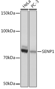 Western blot analysis of various lysates using SENP1 Rabbit mAb at 1:1000 dilution.|Secondary antibody: HRP-conjugated Goat anti-Rabbit IgG (H+L) at 1:10000 dilution.|Lysates/proteins: 25μg per lane.|Blocking buffer: 3% nonfat dry milk in TBST.|Detection: ECL Basic Kit.|Exposure time: 1s.