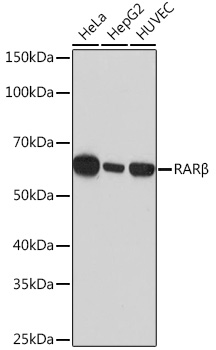 Western blot analysis of various lysates using RARβ Rabbit mAb at 1:1000 dilution.|Secondary antibody: HRP-conjugated Goat anti-Rabbit IgG (H+L) at 1:10000 dilution.|Lysates/proteins: 25μg per lane.|Blocking buffer: 3% nonfat dry milk in TBST.|Detection: ECL Basic Kit.|Exposure time: 30s.