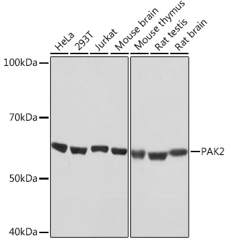 Western blot analysis of various lysates using PAK2 Rabbit mAb at 1:1000 dilution.|Secondary antibody: HRP-conjugated Goat anti-Rabbit IgG (H+L) at 1:10000 dilution.|Lysates/proteins: 25μg per lane.|Blocking buffer: 3% nonfat dry milk in TBST.|Detection: ECL Basic Kit.|Exposure time: 10s.