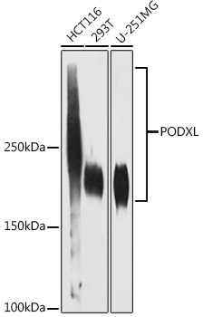 Western blot analysis of various lysates using PODXL Rabbit mAb at 1:1000 dilution.|Secondary antibody: HRP-conjugated Goat anti-Rabbit IgG (H+L) at 1:10000 dilution.|Lysates/proteins: 25μg per lane.|Blocking buffer: 3% nonfat dry milk in TBST.|Detection: ECL Enhanced Kit.|Exposure time: 180s.