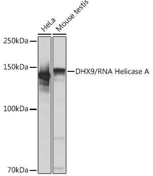 Western blot analysis of various lysates using DHX9/RNA Helicase A Rabbit mAb at 1:1000 dilution.|Secondary antibody: HRP-conjugated Goat anti-Rabbit IgG (H+L) at 1:10000 dilution.|Lysates/proteins: 25μg  per lane.|Blocking buffer: 3% nonfat dry milk in TBST.|Detection: ECL Basic Kit.|Exposure time: 1s.