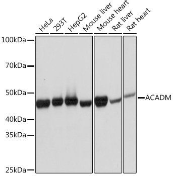 Western blot analysis of various lysates using ACADM Rabbit mAb at 1:1000 dilution.|Secondary antibody: HRP-conjugated Goat anti-Rabbit IgG (H+L) at 1:10000 dilution.|Lysates/proteins: 25μg per lane.|Blocking buffer: 3% nonfat dry milk in TBST.|Detection: ECL Basic Kit.|Exposure time: 1s.