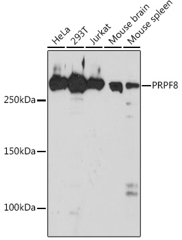 Western blot analysis of various lysates using PRPF8 Rabbit mAb at 1:1000 dilution.|Secondary antibody: HRP-conjugated Goat anti-Rabbit IgG (H+L) at 1:10000 dilution.|Lysates/proteins: 25μg per lane.|Blocking buffer: 3% nonfat dry milk in TBST.|Detection: ECL Basic Kit.|Exposure time: 30s.
