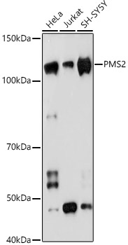 Western blot analysis of various lysates using PMS2 Rabbit mAb at 1:1000 dilution.|Secondary antibody: HRP-conjugated Goat anti-Rabbit IgG (H+L) at 1:10000 dilution.|Lysates/proteins: 25μg per lane.|Blocking buffer: 3% nonfat dry milk in TBST.|Detection: ECL Basic Kit.|Exposure time: 90s.