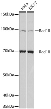Western blot analysis of various lysates using Rad18 Rabbit mAb at 1:1000 dilution incubated overnight at 4℃.|Secondary antibody: HRP-conjugated Goat anti-Rabbit IgG (H+L) at 1:10000 dilution.|Lysates/proteins: 25 μg per lane.|Blocking buffer: 3% nonfat dry milk in TBST.|Detection: ECL Basic Kit.|Exposure time: 10 s.