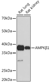 Western blot analysis of various lysates using AMPKβ1 Rabbit mAb at 1:1000 dilution.|Secondary antibody: HRP-conjugated Goat anti-Rabbit IgG (H+L) at 1:10000 dilution.|Lysates/proteins: 25μg per lane.|Blocking buffer: 3% nonfat dry milk in TBST.|Detection: ECL Basic Kit.|Exposure time: 60s.