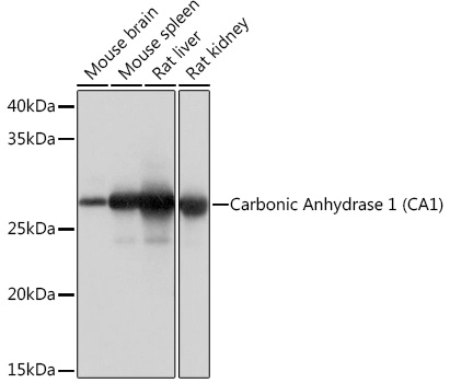 Western blot analysis of various lysates using Carbonic Anhydrase 1 (CA1) (CA1) Rabbit mAb at 1:1000 dilution.|Secondary antibody: HRP-conjugated Goat anti-Rabbit IgG (H+L) at 1:10000 dilution.|Lysates/proteins: 25μg per lane.|Blocking buffer: 3% nonfat dry milk in TBST.|Detection: ECL Basic Kit.|Exposure time: 1s.
