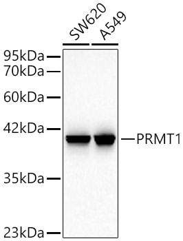 Western blot analysis of various lysates using PRMT1 Rabbit mAb at 1:1000 dilution incubated overnight at 4℃.|Secondary antibody: HRP-conjugated Goat anti-Rabbit IgG (H+L) at 1:10000 dilution.|Lysates/proteins: 25 μg per lane.|Blocking buffer: 3% nonfat dry milk in TBST.|Detection: ECL Basic Kit.|Exposure time: 90s.