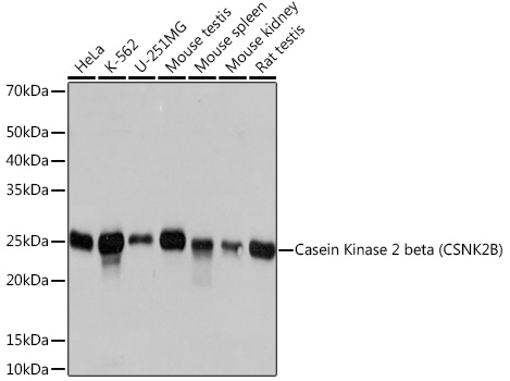 Western blot analysis of various lysates using Casein Kinase 2 beta (CSNK2B) (CSNK2B) Rabbit mAb at 1:1000 dilution.|Secondary antibody: HRP-conjugated Goat anti-Rabbit IgG (H+L) at 1:10000 dilution.|Lysates/proteins: 25μg per lane.|Blocking buffer: 3% nonfat dry milk in TBST.|Detection: ECL Basic Kit.|Exposure time: 3s.