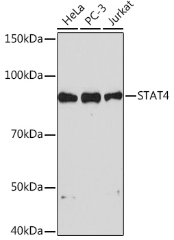 Western blot analysis of various lysates using STAT4 Rabbit mAb at 1:1000 dilution.|Secondary antibody: HRP-conjugated Goat anti-Rabbit IgG (H+L) at 1:10000 dilution.|Lysates/proteins: 25μg per lane.|Blocking buffer: 3% nonfat dry milk in TBST.|Detection: ECL Basic Kit.|Exposure time: 90s.